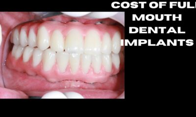 cost of full mouth dental implants