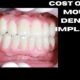 cost of full mouth dental implants