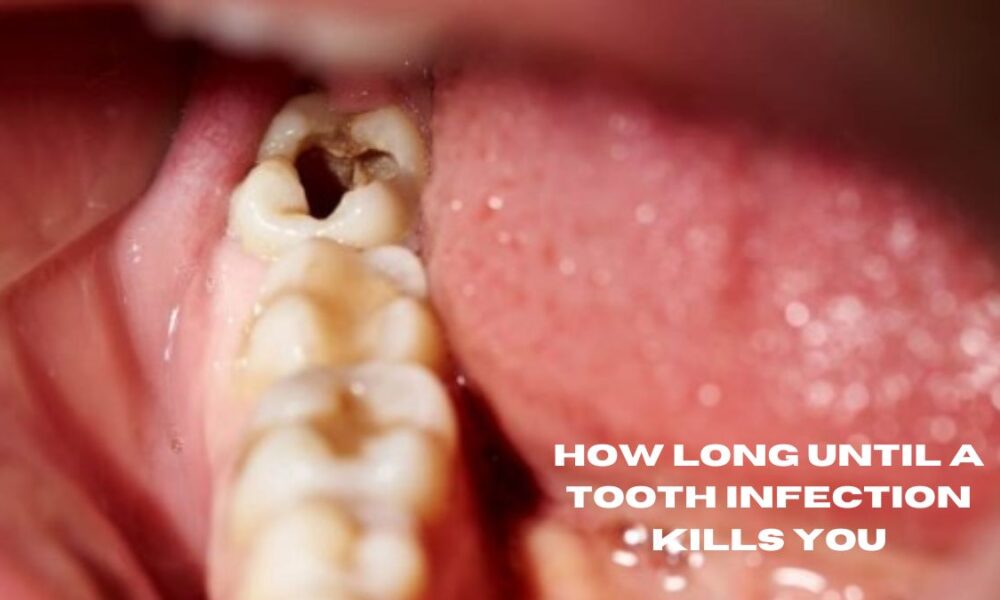 how long until a tooth infection kills you