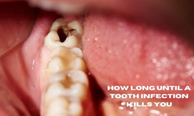 how long until a tooth infection kills you