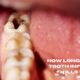 how long until a tooth infection kills you