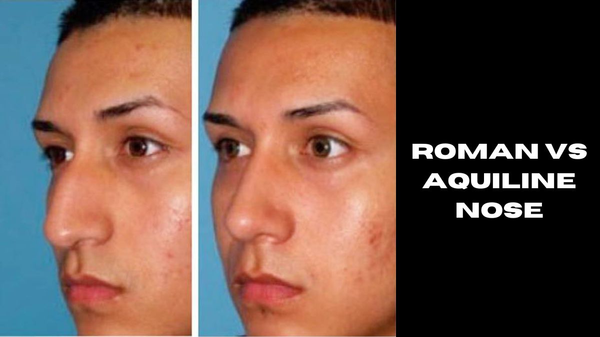 roman vs aquiline nose