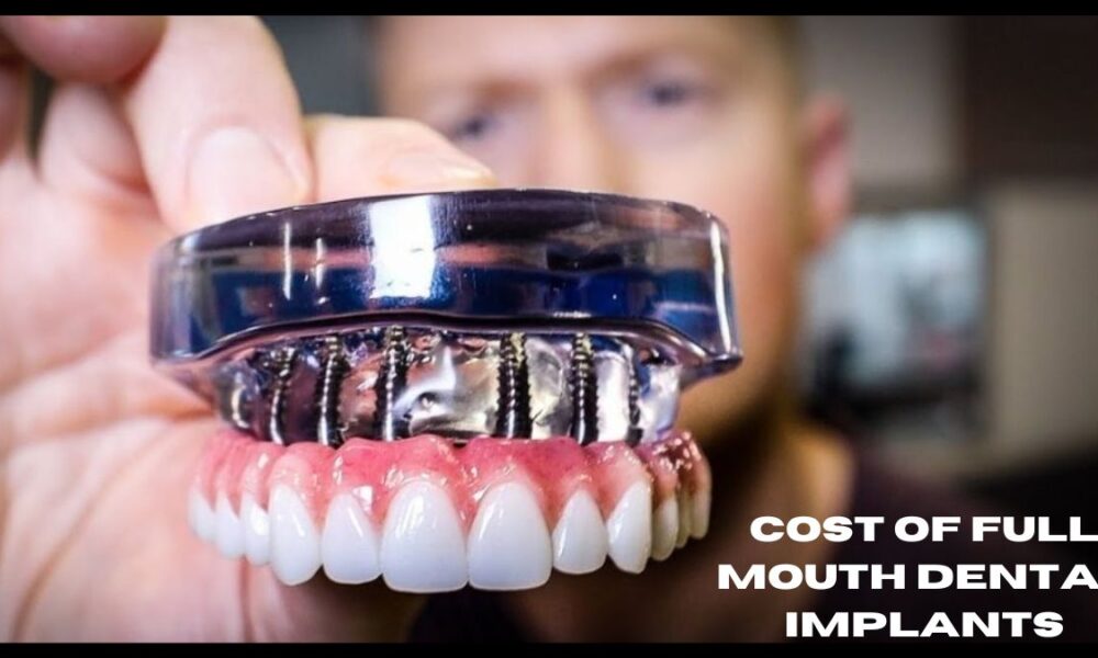 cost of full mouth dental implants