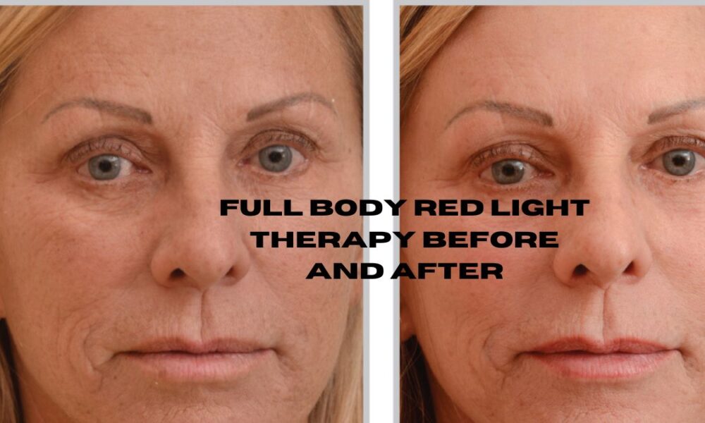 full body red light therapy before and after